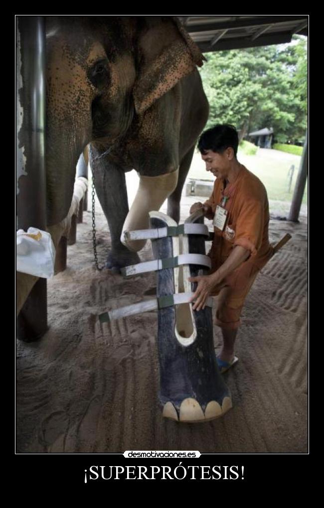 ¡SUPERPRÓTESIS! -