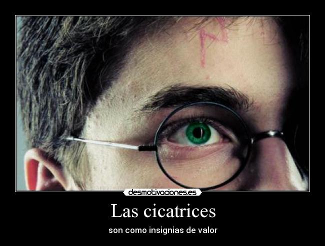 Las cicatrices - 