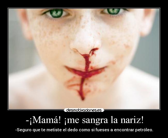-¡Mamá! ¡me sangra la nariz! - -Seguro que te metiste el dedo como si fueses a encontrar petróleo.