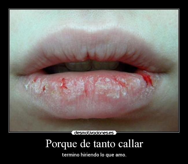 Porque de tanto callar - 