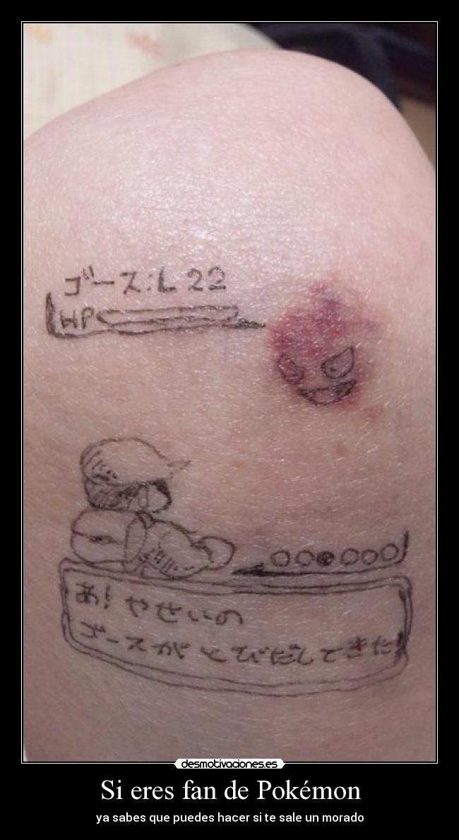 Si eres fan de Pokémon - ya sabes que puedes hacer si te sale un morado