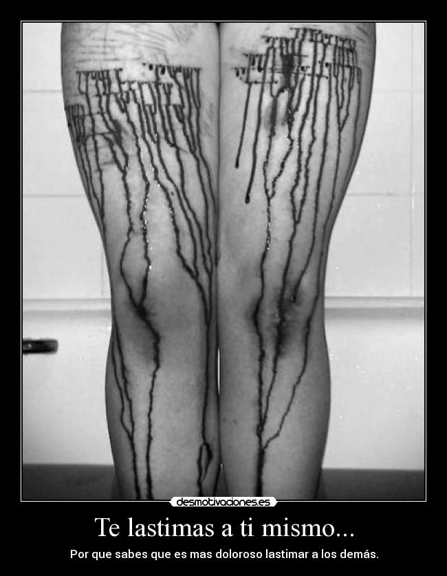 Te lastimas a ti mismo... - Por que sabes que es mas doloroso lastimar a los demás.
