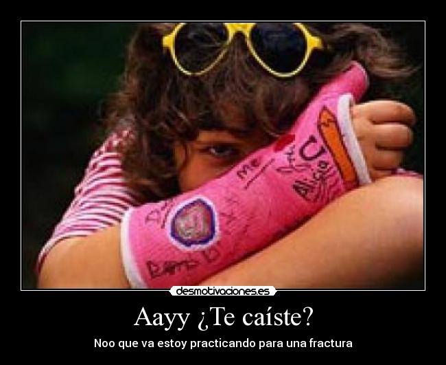 Aayy ¿Te caíste? -
