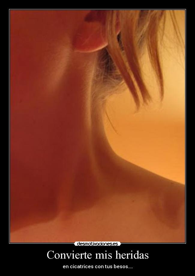Convierte mis heridas -
