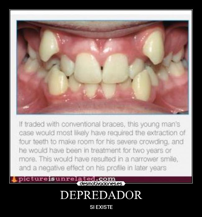 DEPREDADOR - SI EXISTE