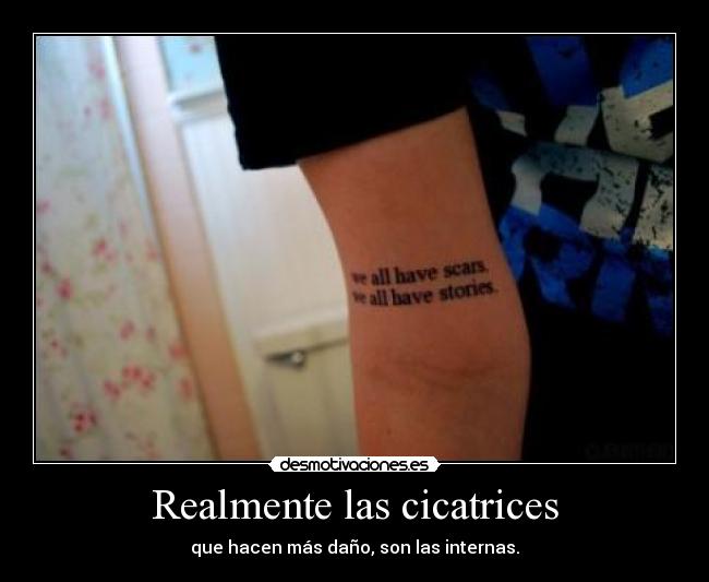 Realmente las cicatrices - que hacen más daño, son las internas.