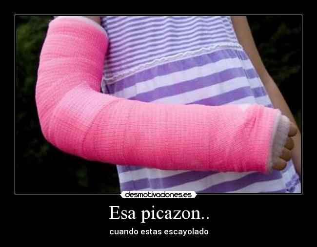 Esa picazon.. - cuando estas escayolado