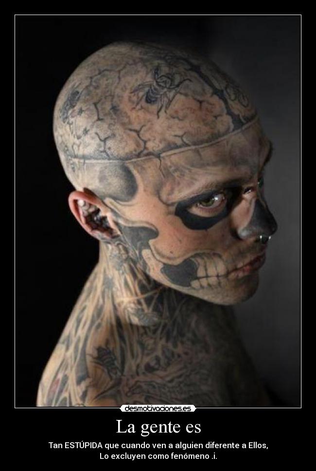 La gente es - Tan ESTÚPIDA que cuando ven a alguien diferente a Ellos,
Lo excluyen como fenómeno .i.