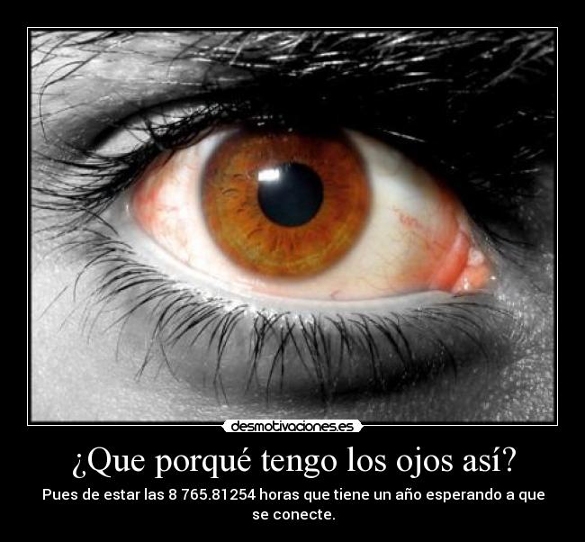 ¿Que porqué tengo los ojos así? - Pues de estar las 8 765.81254 horas que tiene un año esperando a que se conecte.