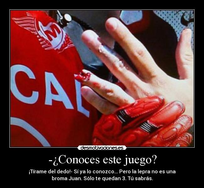 -¿Conoces este juego? - ¡Tírame del dedo!- Sí ya lo conozco... Pero la lepra no es una
broma Juan. Sólo te quedan 3. Tú sabrás.