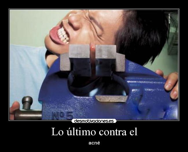 Lo último contra el - acné