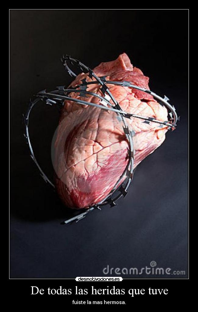 De todas las heridas que tuve - fuiste la mas hermosa.