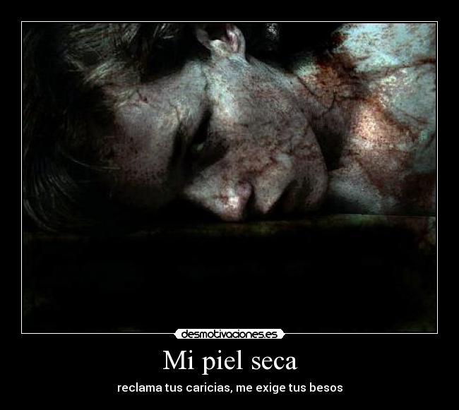 Mi piel seca - 