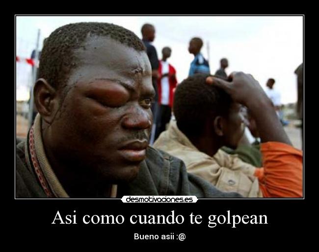 Asi como cuando te golpean -