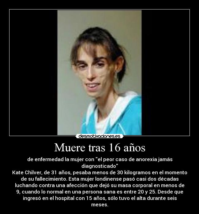 Muere tras 16 años - de enfermedad la mujer con el peor caso de anorexia jamás
diagnosticado
Kate Chilver, de 31 años, pesaba menos de 30 kilogramos en el momento
de su fallecimiento. Esta mujer londinense pasó casi dos décadas
luchando contra una afección que dejó su masa corporal en menos de
9, cuando lo normal en una persona sana es entre 20 y 25. Desde que
ingresó en el hospital con 15 años, sólo tuvo el alta durante seis
meses.