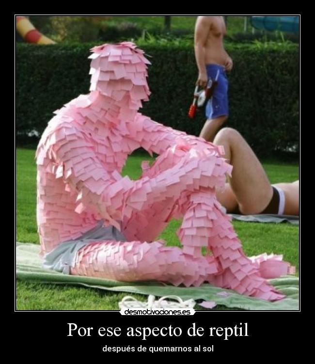 Por ese aspecto de reptil - después de quemarnos al sol