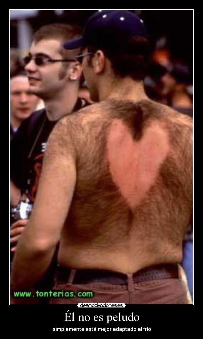 Él no es peludo -