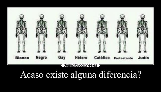 Acaso existe alguna diferencia? - 