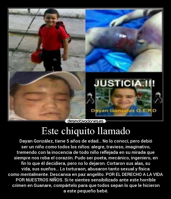 Este chiquito llamado - Dayan González, tiene 5 años de edad... No lo conocí, pero debió
ser un niño como todos los niños: alegre, travieso, imaginativo,
tremendo con la inocencia de todo niño reflejada en su mirada que
siempre nos roba el corazón. Pudo ser poeta, mecánico, ingeniero, en
fin lo que él decidiera, pero no lo dejaron. Cortaron sus alas, su
vida, sus sueños... Lo torturaon, abusaron tanto sexual y física
como mentalmente. Descansa en paz angelito. POR EL DERECHO A LA VIDA,
POR NUESTROS NIÑOS. Si te sientes sensibilizado ante este horrible
crimen en Guanare, compártelo para que todos sepan lo que le hicieron
a este pequeño bebé.