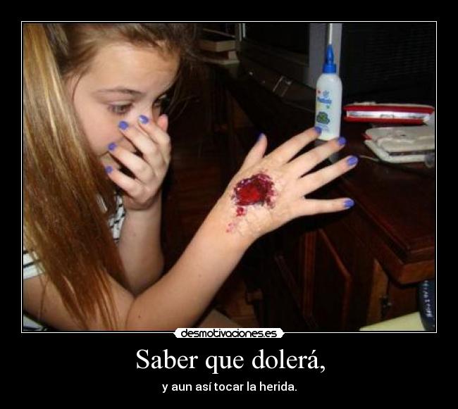 Saber que dolerá, -