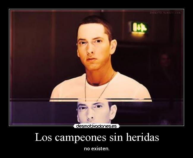 Los campeones sin heridas - no existen.