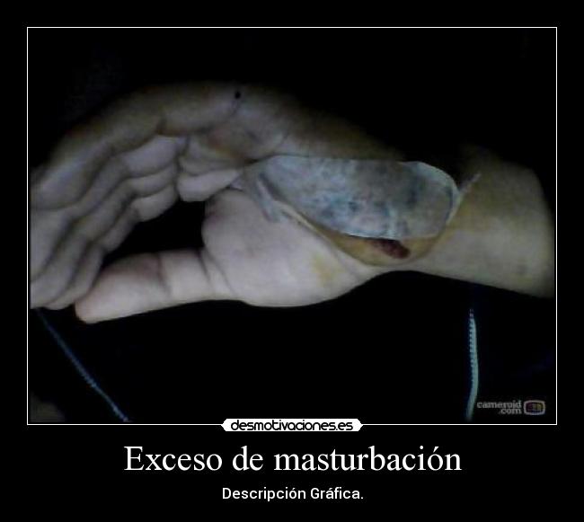 Exceso de masturbación -