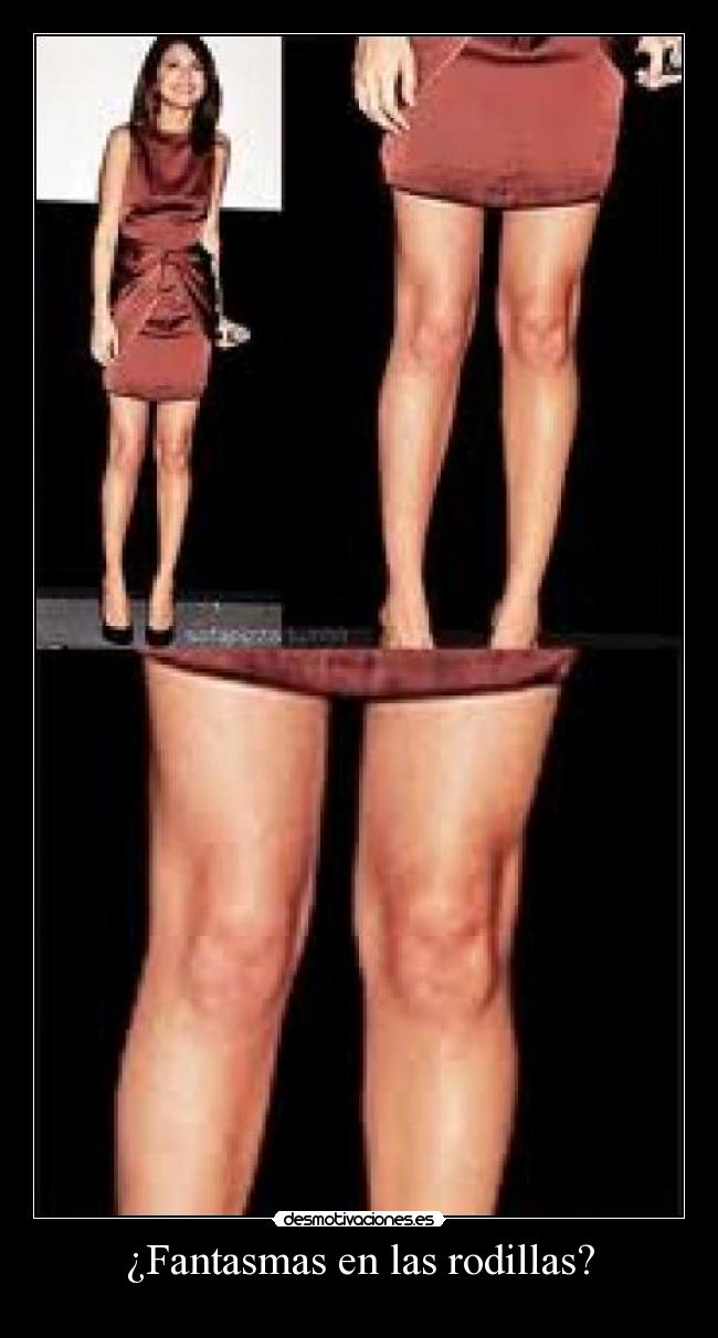 ¿Fantasmas en las rodillas? -