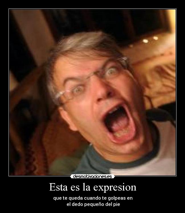 Esta es la expresion - 