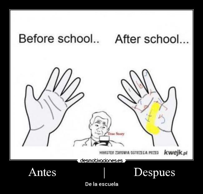 Antes               |         Despues - 