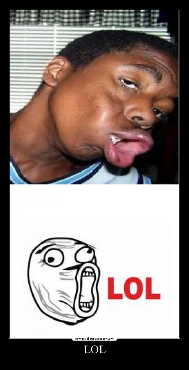 LOL -