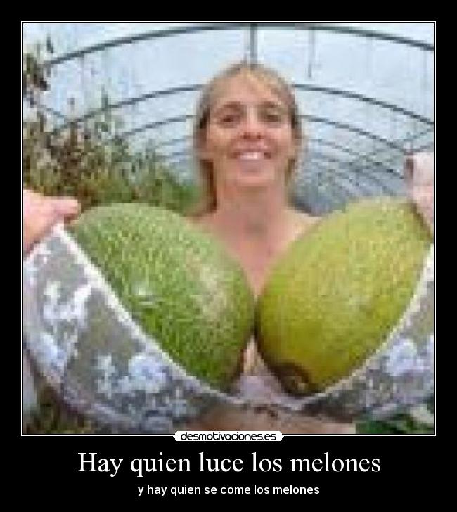 Hay quien luce los melones - y hay quien se come los melones