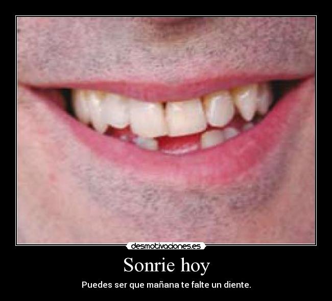 Sonrie hoy - Puedes ser que mañana te falte un diente.