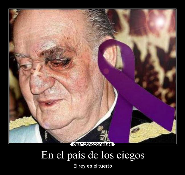 En el país de los ciegos - El rey es el tuerto