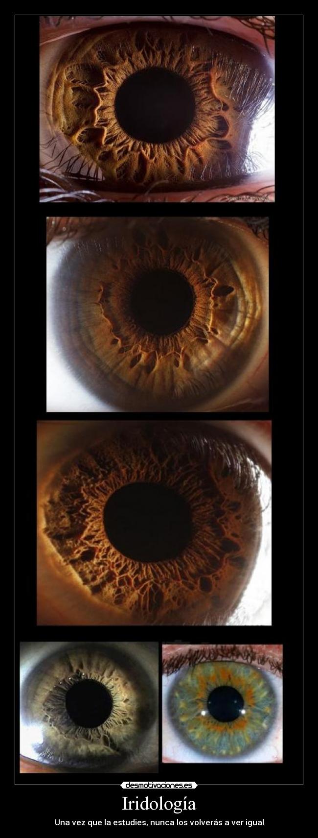 Iridología - 