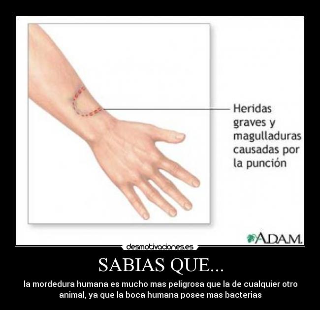 SABIAS QUE... - la mordedura humana es mucho mas peligrosa que la de cualquier otro
animal, ya que la boca humana posee mas bacterias