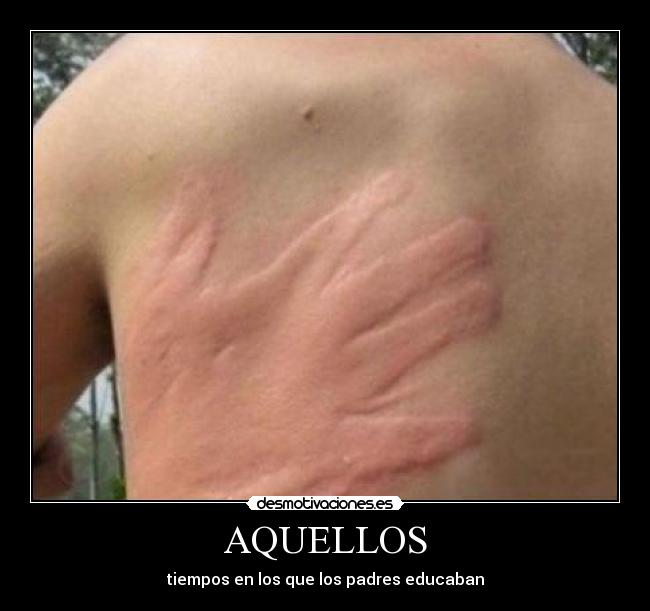 AQUELLOS -