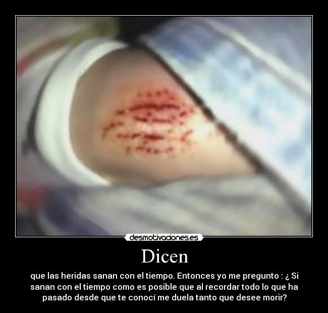 Dicen - que las heridas sanan con el tiempo. Entonces yo me pregunto : ¿ Si
sanan con el tiempo como es posible que al recordar todo lo que ha
pasado desde que te conocí me duela tanto que desee morir?