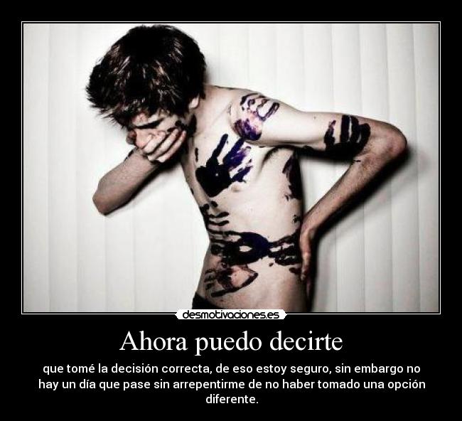 Ahora puedo decirte - que tomé la decisión correcta, de eso estoy seguro, sin embargo no
hay un día que pase sin arrepentirme de no haber tomado una opción
diferente.