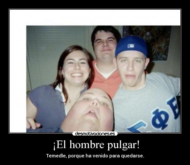 ¡El hombre pulgar! - 