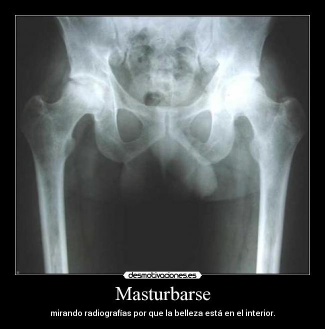 Masturbarse - mirando radiografías por que la belleza está en el interior.