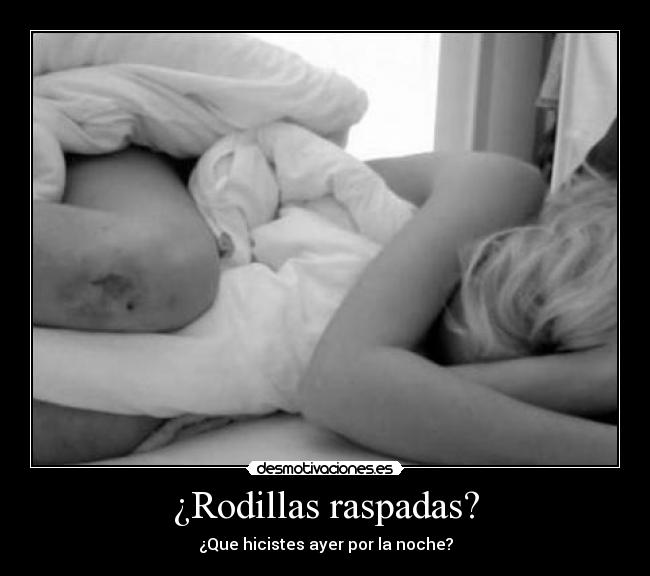 ¿Rodillas raspadas? - 