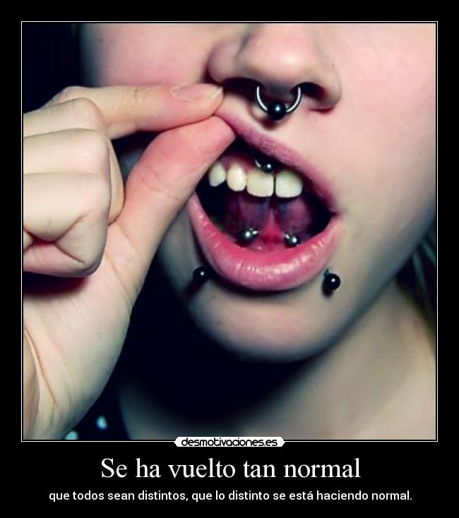 Se ha vuelto tan normal -