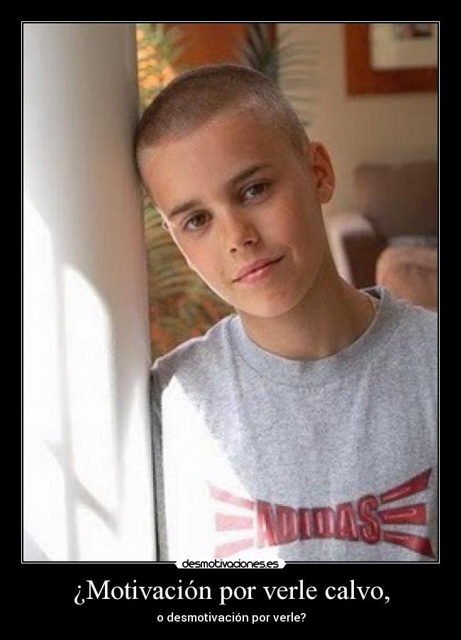 ¿Motivación por verle calvo, - 