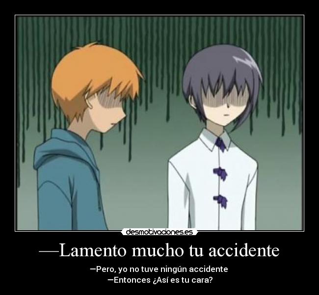 —Lamento mucho tu accidente - —Pero, yo no tuve ningún accidente
—Entonces ¿Así es tu cara?