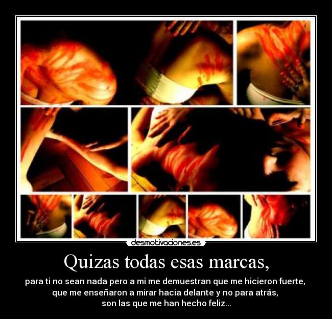 Quizas todas esas marcas, - para ti no sean nada pero a mi me demuestran que me hicieron fuerte,
que me enseñaron a mirar hacia delante y no para atrás,
son las que me han hecho feliz...