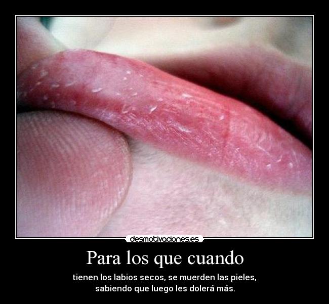 Para los que cuando - tienen los labios secos, se muerden las pieles,
sabiendo que luego les dolerá más.