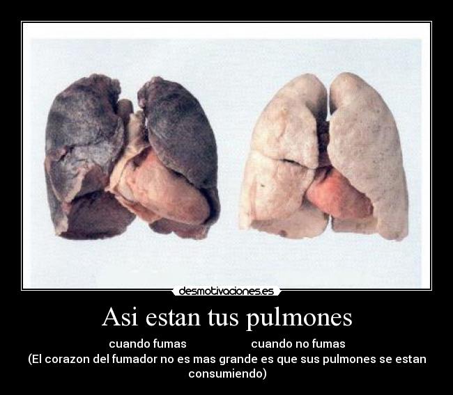 Asi estan tus pulmones - 