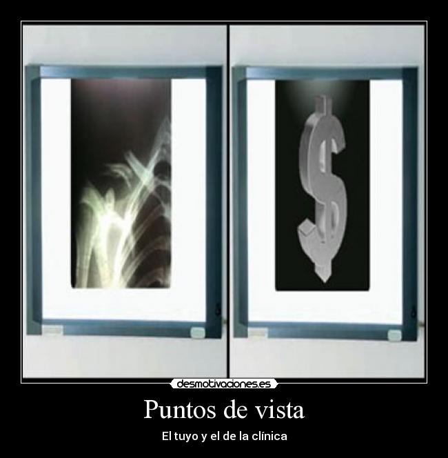 Puntos de vista -