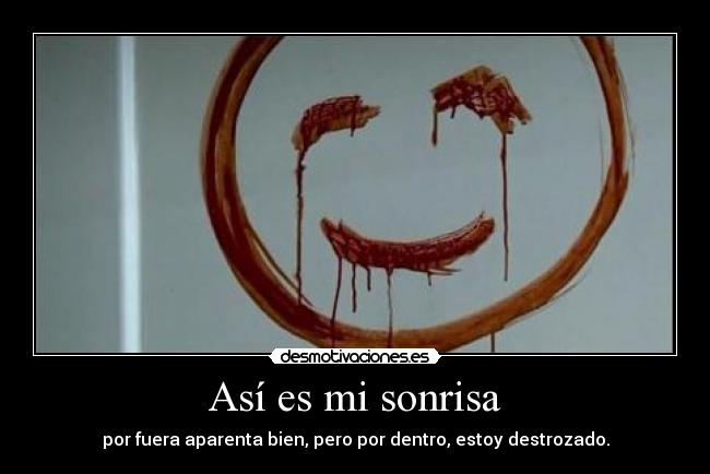 Así es mi sonrisa -