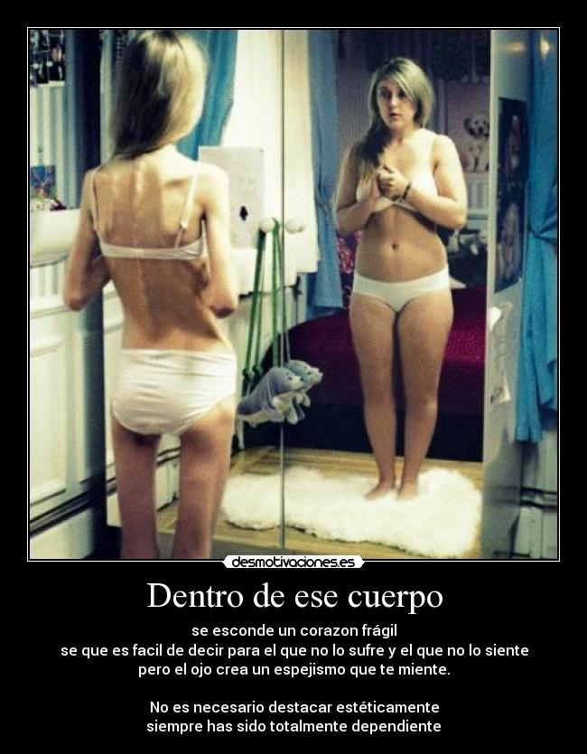 Dentro de ese cuerpo - se esconde un corazon frágil
se que es facil de decir para el que no lo sufre y el que no lo siente
pero el ojo crea un espejismo que te miente.
No es necesario destacar estéticamente
siempre has sido totalmente dependiente♫